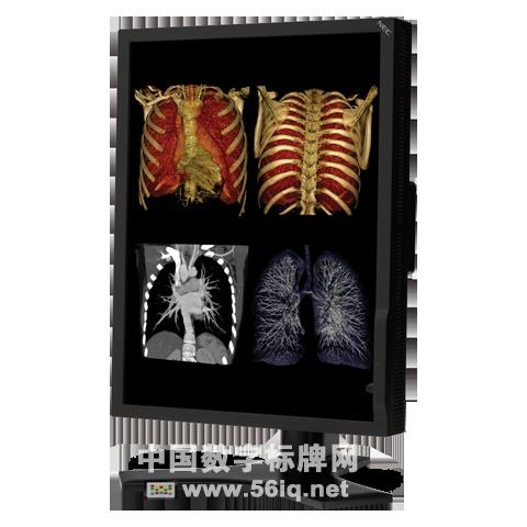 NEC升級醫(yī)用數(shù)字顯示器產(chǎn)品系列,信息顯示系統(tǒng),多媒體信息發(fā)布系統(tǒng),數(shù)字標牌,digital signage