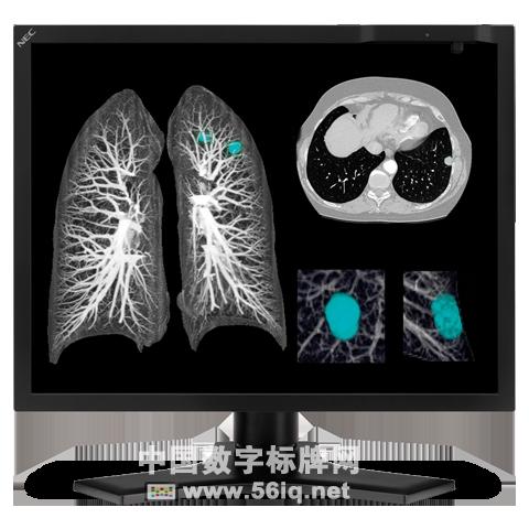 NEC升級醫(yī)用數(shù)字顯示器產(chǎn)品系列,信息顯示系統(tǒng),多媒體信息發(fā)布系統(tǒng),數(shù)字標牌,digital signage