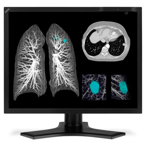 手勢平板:服務(wù)醫(yī)療行業(yè)的創(chuàng)新數(shù)字標(biāo)牌應(yīng)用,信息顯示系統(tǒng),多媒體信息發(fā)布系統(tǒng),數(shù)字標(biāo)牌,數(shù)字告示,digital signage 手勢平板:服務(wù)醫(yī)療行業(yè)的創(chuàng)新數(shù)字標(biāo)牌應(yīng)用,信息顯示系統(tǒng),多媒體信息發(fā)布系統(tǒng),數(shù)字標(biāo)牌,數(shù)字告示,digital signage